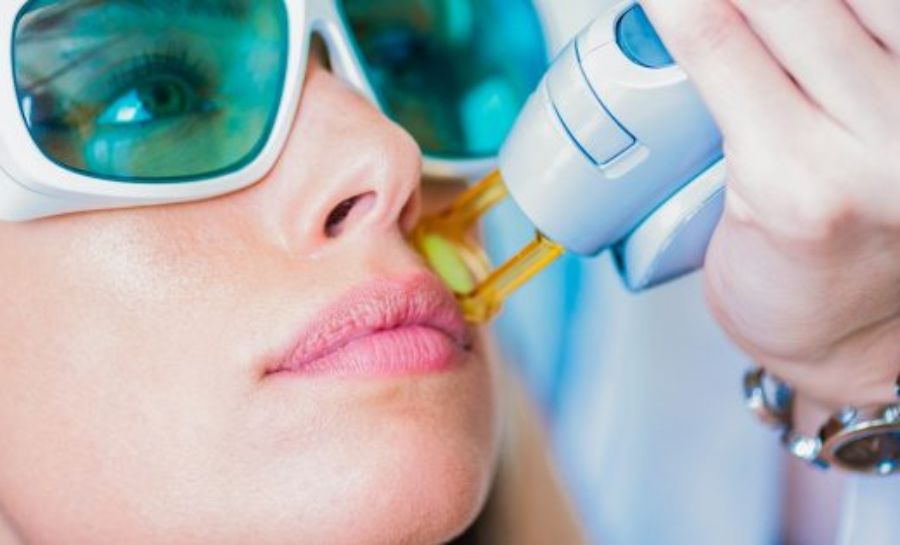 Micro Needling
