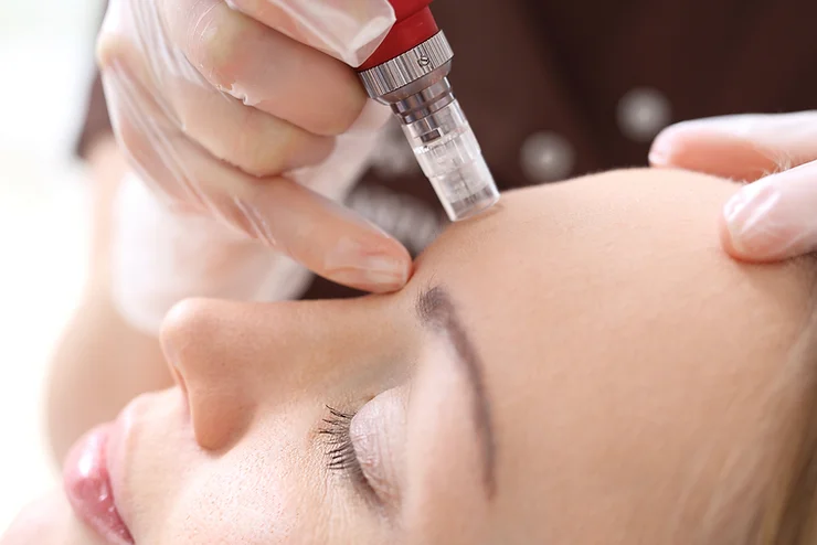 Unveiling the Beauty Secrets